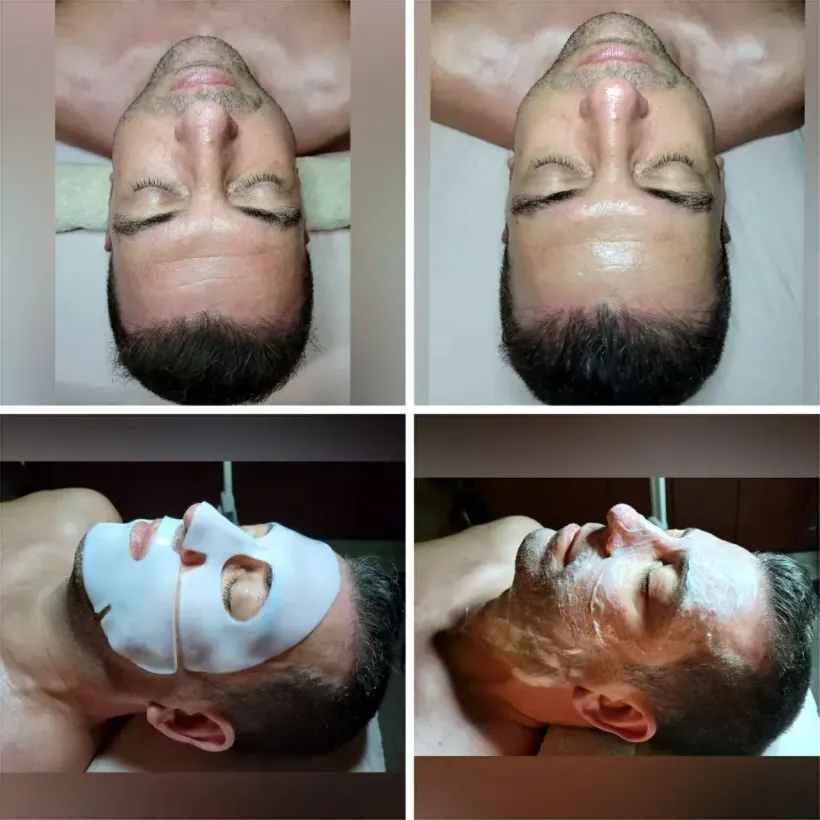A facial for men in Scottsdale — cleansing, extractions and a hydrating mask, before and after